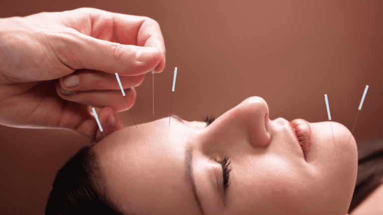 Top Acupuncture Website Design Ideas & Tips – Best Guide
